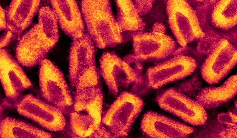 Rabies — A Deadly Disease That Can Be Prevented